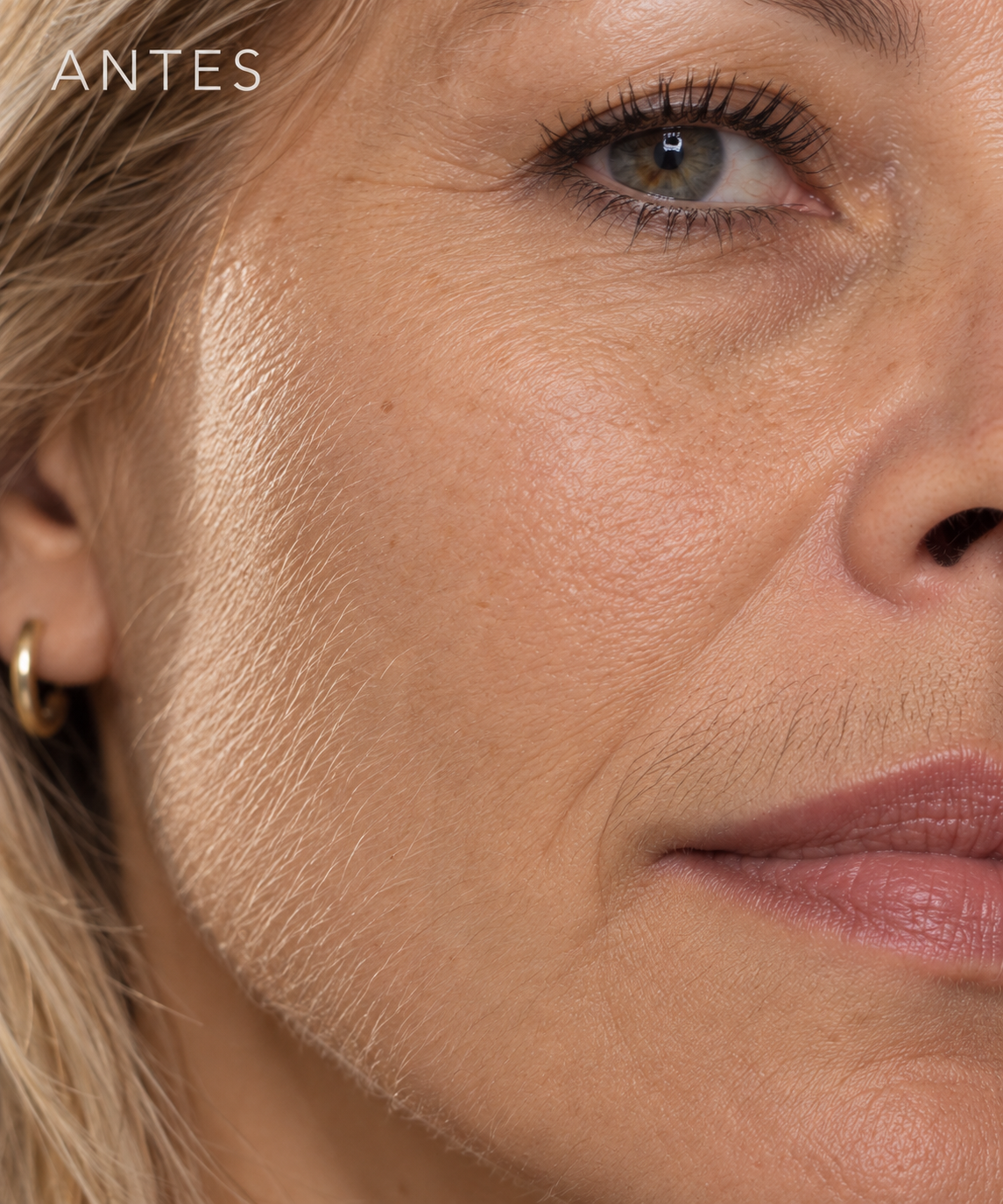 Antes: vello facial fino, depilador Glowvest